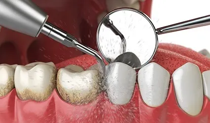 Smiling woman in dental chair