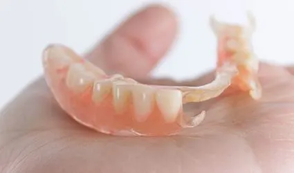 Partial denture prior to placement