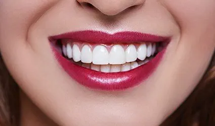 Closeup of flawless teeth and gums