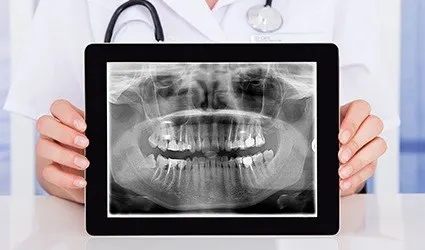 Dentist holding up x-rays on tablet computer