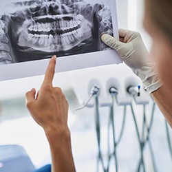 patient and dentist look at X-ray after bone grating in Park City